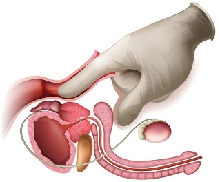prostata Massage