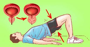 Übung fir Prostatitis