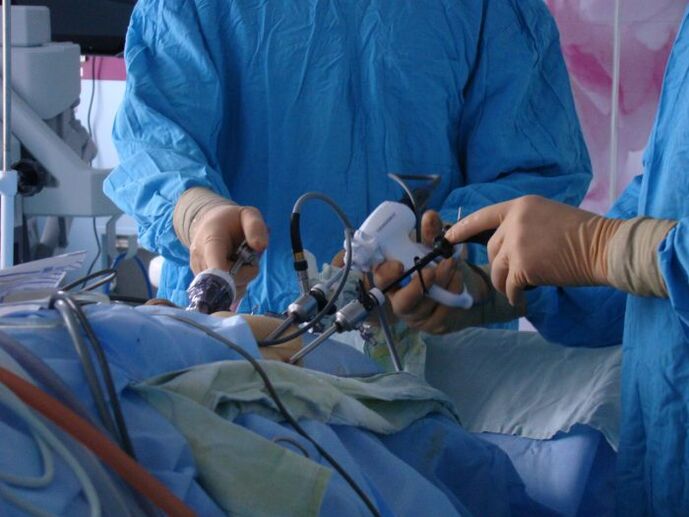 chirurgesch Behandlung vu Prostatitis