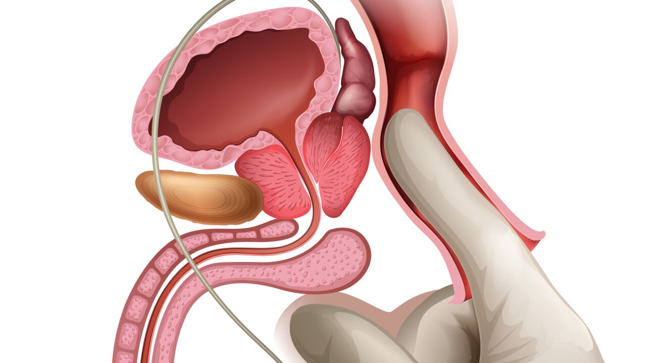 Prostata Massage ass eng effektiv Manéier fir congestive Prostatitis ze behandelen