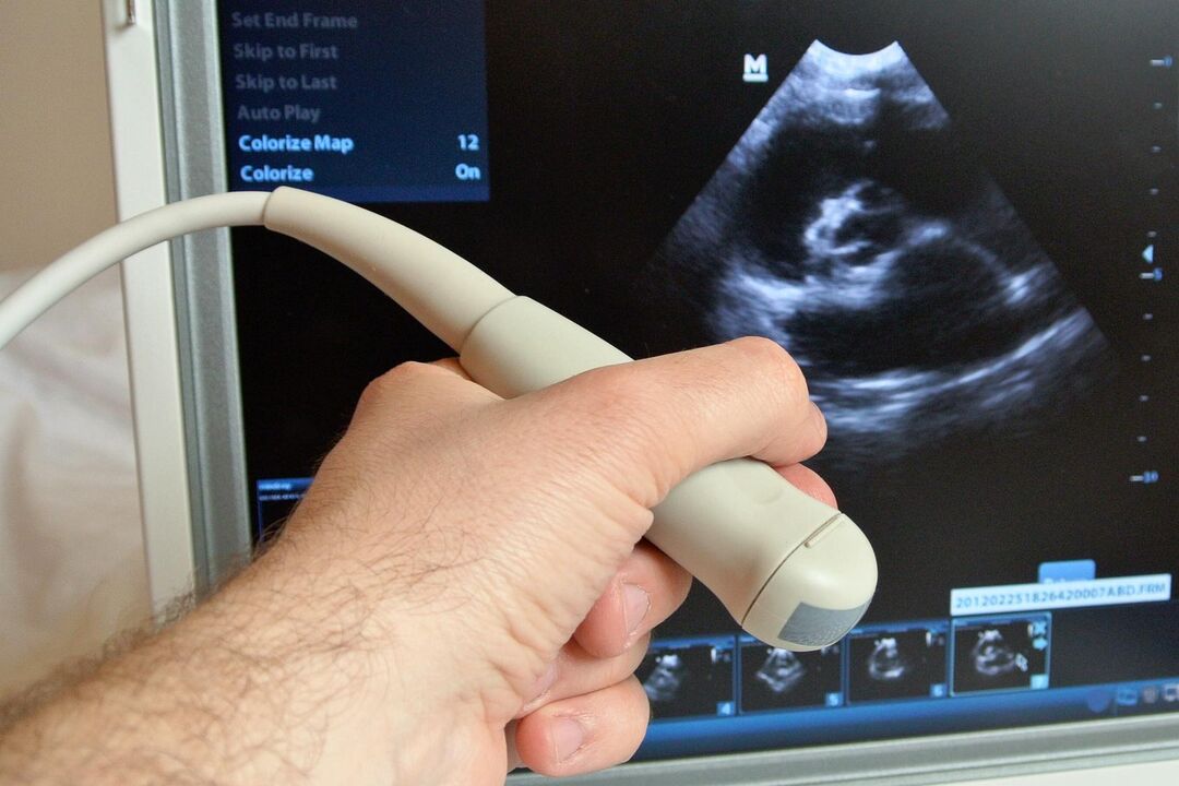 Ultraschall hëlleft bei engem Mann congestive Prostatitis ze diagnostizéieren